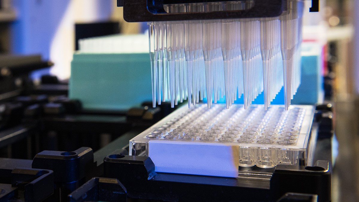 Serological testing of specimens at a laboratory using a specialized machine.