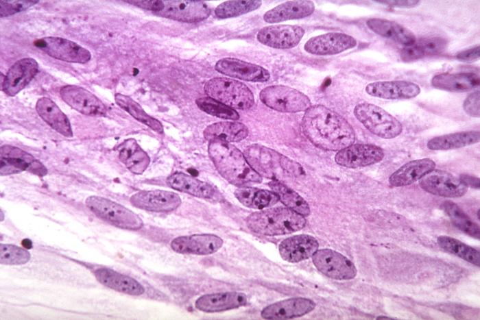 Photomicrograph of varicella-zoster virus This photomicrograph reveals the intranuclear inclusions produced by the varicella-zoster virus grown in a tissue culture; Magnified 500X.