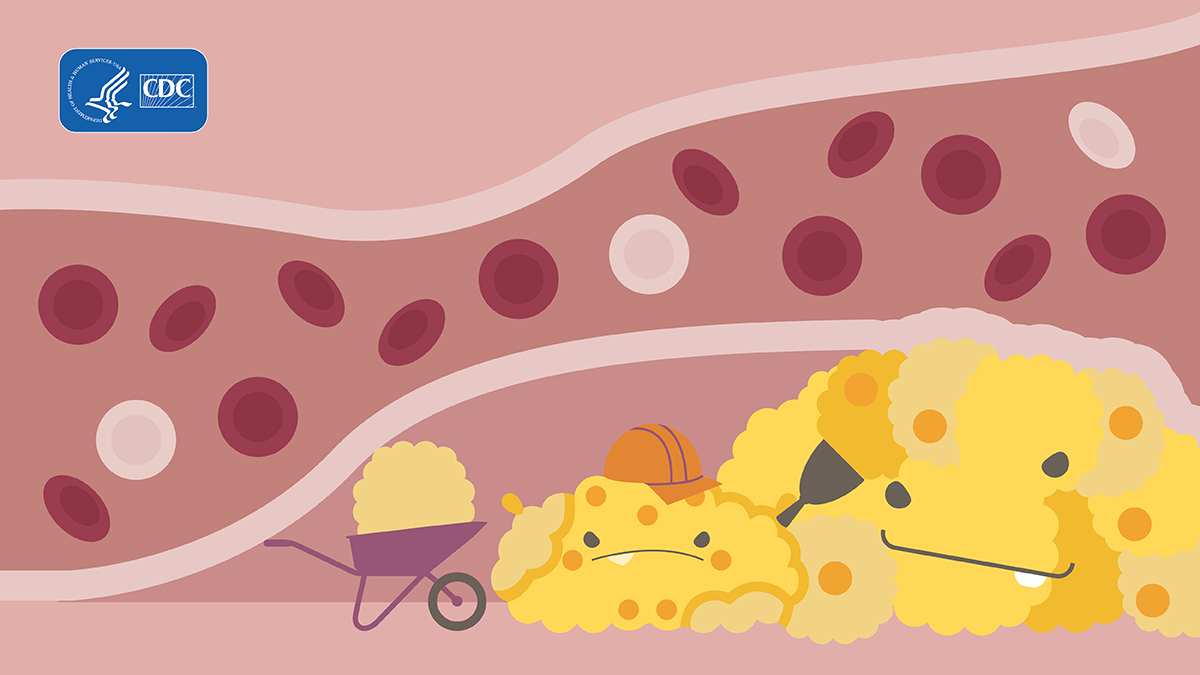 Illustration of two larger and one smaller cholesterol monsters.