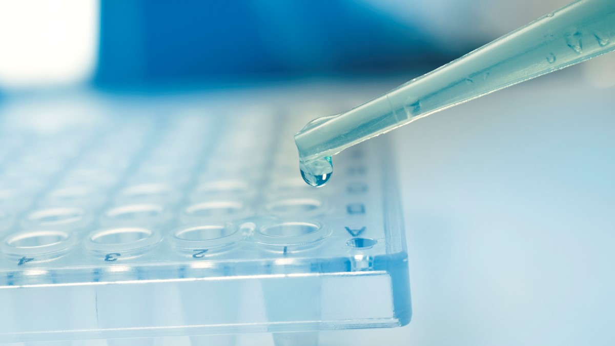 An image of a pipette dropping a liquid into a test tray.