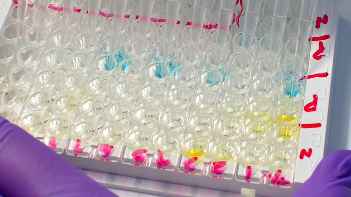 An image of test tubes lined up in a test tray.