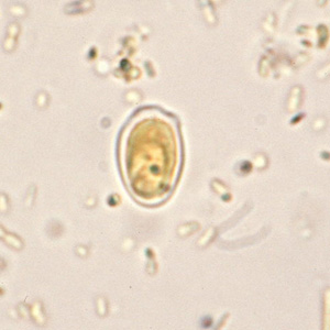 artifact-giardia1.jpg