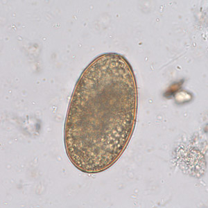A_lumbricoides_infert_Leiden_A.jpg