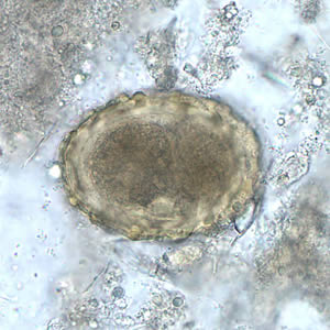 Ascaris_egg_fert_embryo.jpg