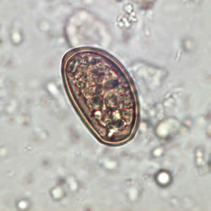 D_dendriticum_egg_wtmt_JCG_C.jpg