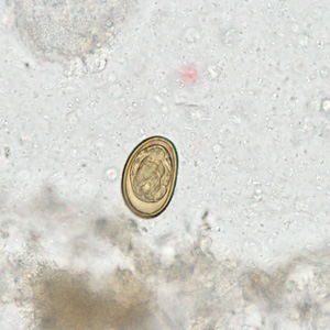 Dicrocoelium_HB1.jpg