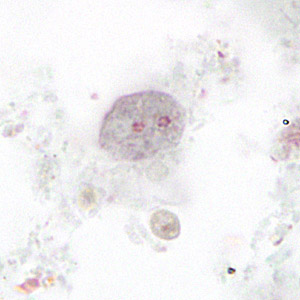 D_fragilis_binuc_HSB_MCS1.jpg Figure B