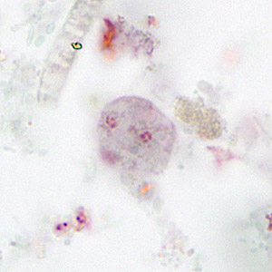D_fragilis_binuc_HSB_MCS2.jpg Figure C