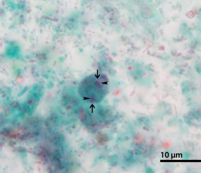 Df_labels_A parasitic image