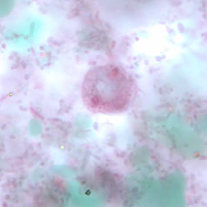 Dfragilis_troph_tric5.jpg Figure E