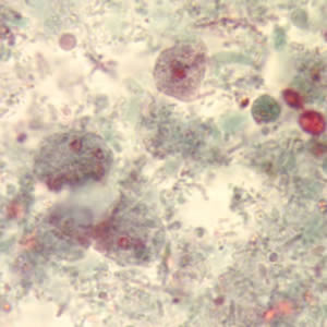 D_fragilis_trichrome.jpg