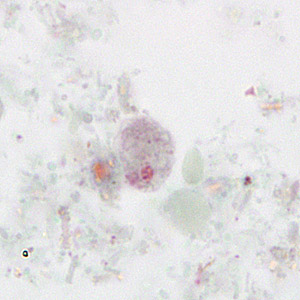 D_fragilis_uninuc_HSB_MCS1.jpg