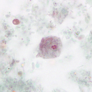 D_fragilis_uninuc_HSB_MCS2.jpg