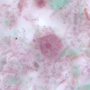 Dfragilis_troph_tric.jpg