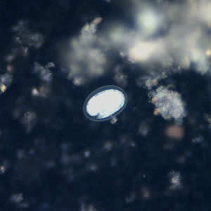 Hookworm_egg_uv_200x.jpg