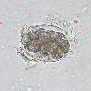 Hookworm_egg_wtmt.jpg