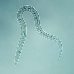 Hookworm_filariform_B.jpg Figure B