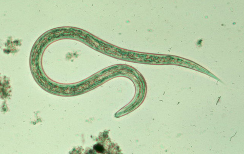 Hookworm_filariform_C.jpg Figure C