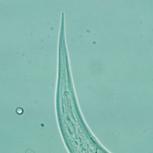 Hookworm_filariform_posterior_A.jpg Figure D