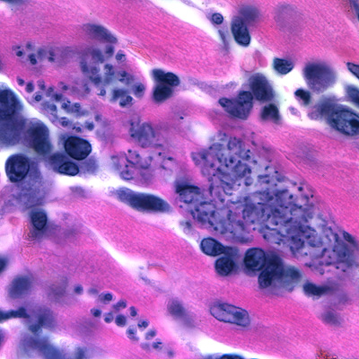 Case176_A.jpg