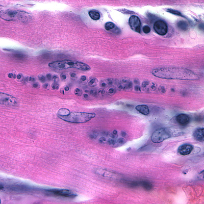 Case176_B.jpg