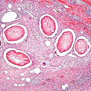 Case193_A.jpg
