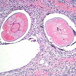 Case193_B.jpg
