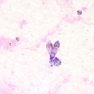 Case211_F.jpg Case211