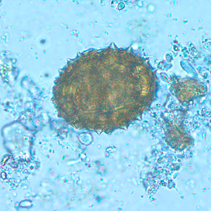 Case216_A.jpg