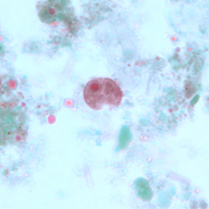 Case243_A.jpg