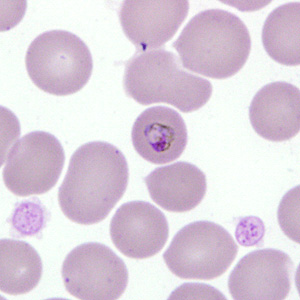 Case277_A.jpg