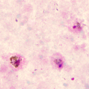 Case285_A.jpg