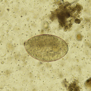 Case329_A.jpg