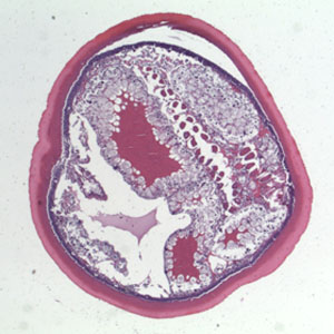 Case364_C.jpg