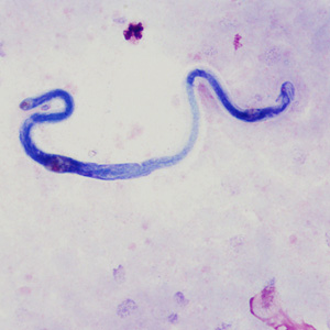 Case370_D.jpg