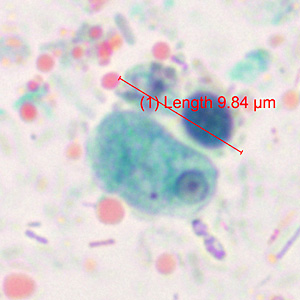 Case371_A.jpg