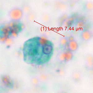 Case371_B.jpg