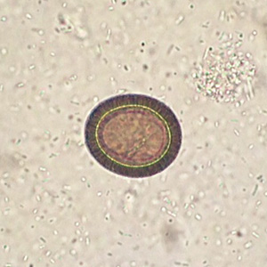 Case375_B.jpg