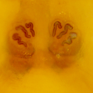 Case379_B.jpg