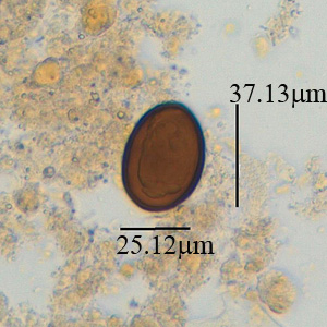 Case381_A.jpg