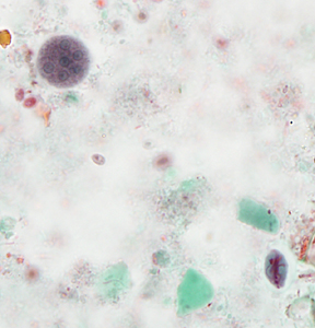 December- 2014 - Case #386