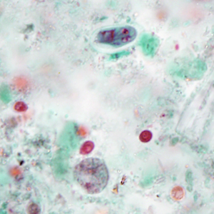 Case386_B.jpg
