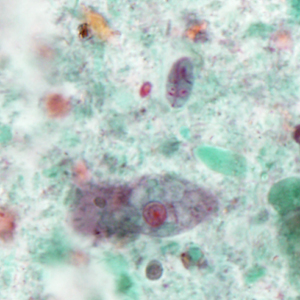 Case386_E.jpg
