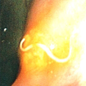 Figure B