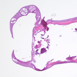 Figure E