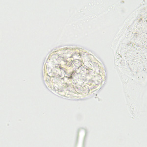 Case422_A.jpg