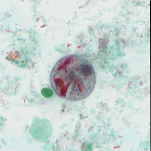case440_D1
