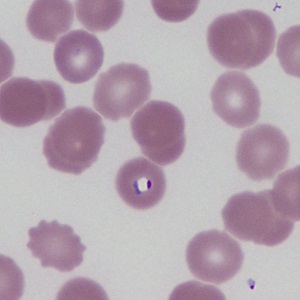 Parasitic image