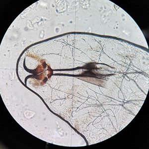 parasitic image