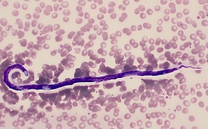 parasitic image